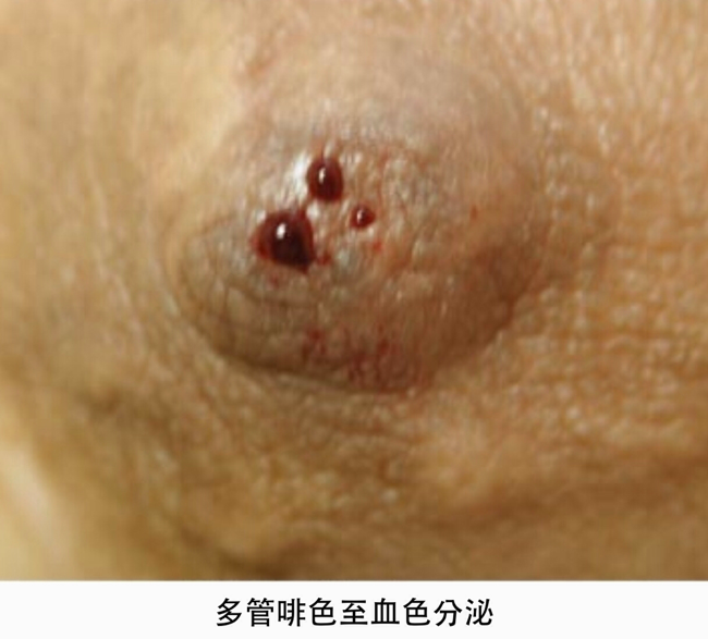 BabettehtyuiRosenberg